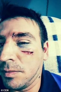 Profesorul batut de tatal fetei agresate sexual