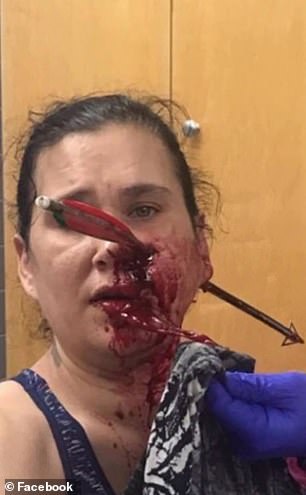 Janet Partain când a ajuns la spital