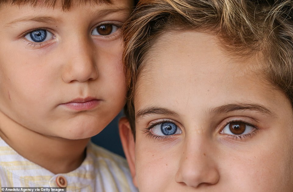 Heterocromia sau ochii de diferite culori Dacă ochii sunt diferiți
