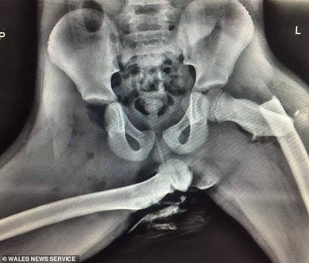 Radiografie accident