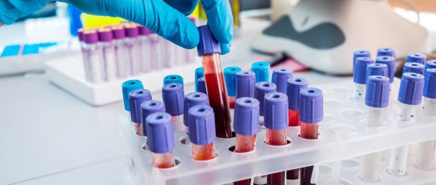 Sânge pentru sânge! Trocul pentru viață din spitalele românești