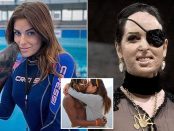 Gessica Notaro prezentatoarea TV desfigurata într-un atac cu acid