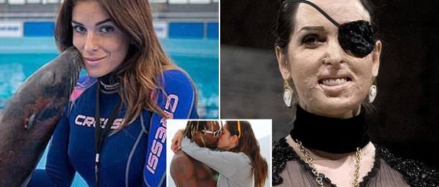 Gessica Notaro prezentatoarea TV desfigurata într-un atac cu acid