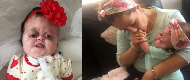 Copilul născut cu o boală rară este îngrijit cu dragoste de părinții săi