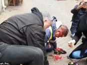Bărbat împușcat în cap cu un flash-ball care este acum la spital în comă
