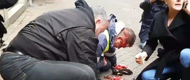 Bărbat împușcat în cap cu un flash-ball care este acum la spital în comă