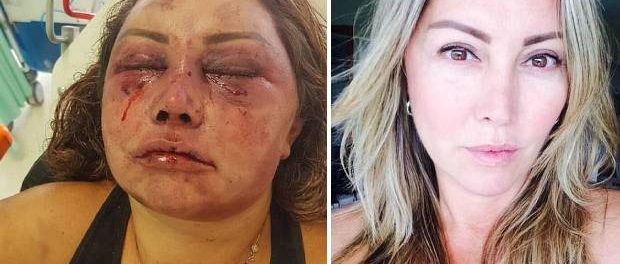 Elaine Caparroz a fost bătută cu sălbăticie în apartamentul ei