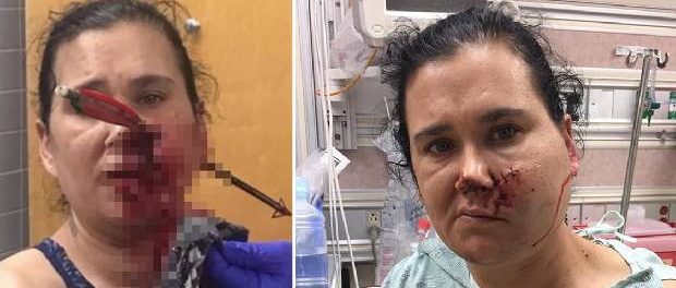 Mama eroină care și-a salvat fiul sărind în fața săgeții Mama eroină care și-a salvat fiul sărind în fața săgeții