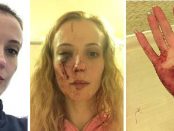 Româncă bătută cu bestialitate într-un atac rasist din Anglia
