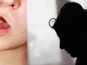 Un bărbat i-a tăiat limba fostei soții din răzbunare