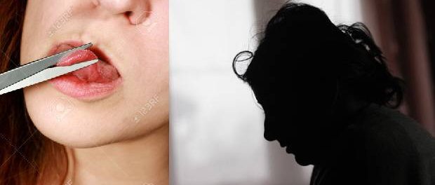 Un bărbat i-a tăiat limba fostei soții din răzbunare