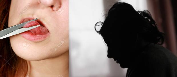 Un bărbat i-a tăiat limba fostei soții din răzbunare