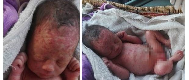 Fetiță nou-născută găsită abandonată și acoperită cu mușcături de furnici și țânțari