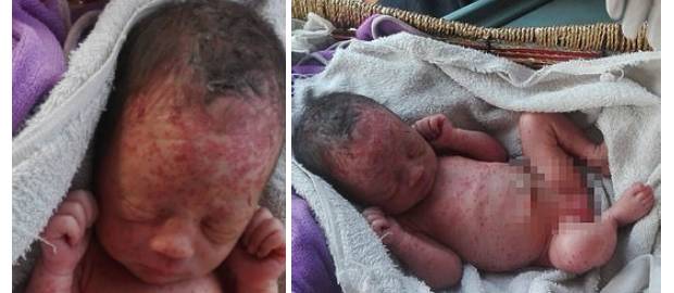 Fetiță nou-născută găsită abandonată și acoperită cu mușcături de furnici și țânțari