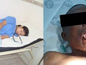 O doctoriță i-a smuls o bună parte din limba bestiei care încerca să o violeze