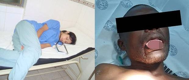 O doctoriță i-a smuls o bună parte din limba bestiei care încerca să o violeze