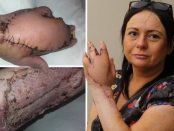 La un pas să moară după ce a fost zgâriată de o pisică maidaneză