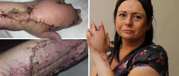 La un pas să moară după ce a fost zgâriată de o pisică maidaneză La un pas să moară după ce a fost zgâriată de o pisică maidaneză