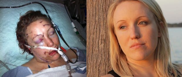 Tânăra înjunghiată de 32 de ori de către un partener abuziv a supraviețuit