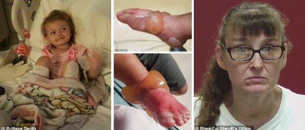 Bunica vitregă i-a opărit picioarele unei fetițe de doi ani