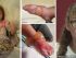 Bunica vitregă i-a opărit picioarele unei fetițe de doi ani