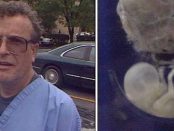 Dr. Ulrich Klopfer cel mai prolific medic de avorturi din SUA avea o colecție de peste 2000 de fetuși