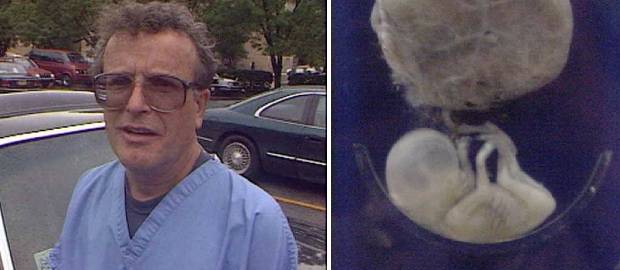 Dr. Ulrich Klopfer cel mai prolific medic de avorturi din SUA avea o colecție de peste 2000 de fetuși