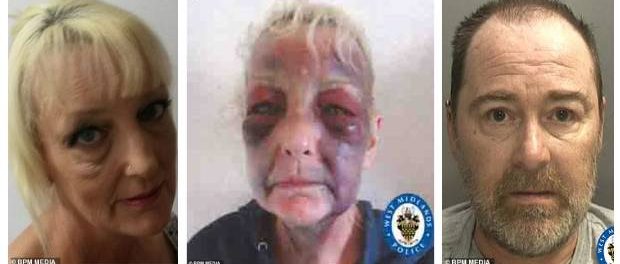 O femeie a distribuit o fotografie îngrozitoare cu rănile provocate de fostul partener