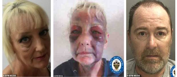 O femeie a distribuit o fotografie îngrozitoare cu rănile provocate de fostul partener