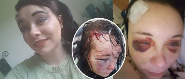 tanara-batuta-prieten-articol Tânăra bătută de prieten