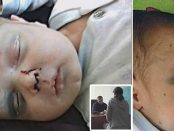 Nou născut de opt luni bătut cu sălbăticie de propria mamă