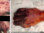 Un bărbat a murit după ce a fost LINS DE CÂINELE SĂU și a contractat o infecție mortală
