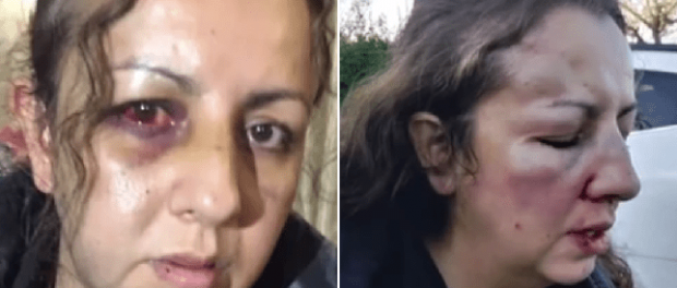 Mamă bătută măr la școală de agresoarea fiicei sale Mamă bătută măr la școală de agresoarea fiicei sale