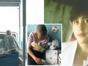 O adolescentă a suferit arsuri groaznice după ce tatăl ei i-a dat foc