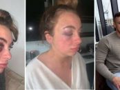 Tânăra bătută de iubitul gelos pentru că nu i-a răspuns noaptea la un SMS