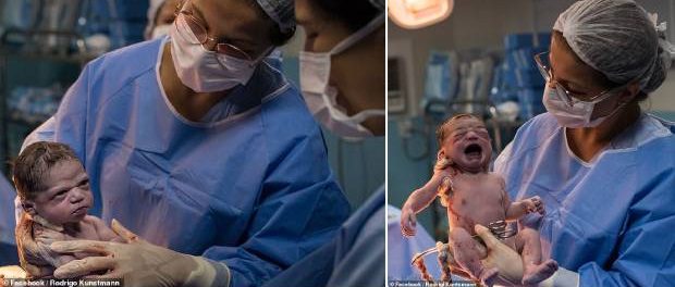 Supărată din prima SECUNDĂ DE VIAȚĂ Fotografia nou-născutei a devenit VIRALĂ