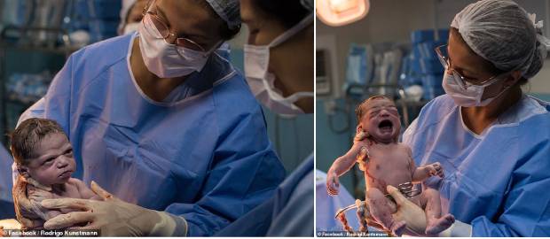 Supărată din prima SECUNDĂ DE VIAȚĂ Fotografia nou-născutei a devenit VIRALĂ