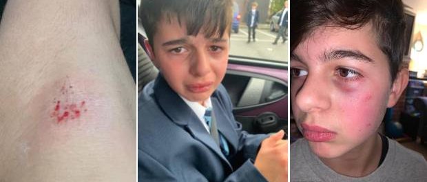 Un băiat autist de 12 ani a fost retras de la școală după ce a fost hărțuit în fiecare zi