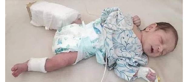 Bebelușul care a supraviețuit miraculos atacului ISIS din Kabul