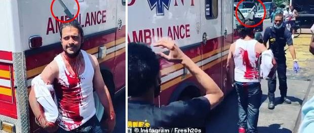 Bărbat cu un cuțit înfipt în cap după ce a încercat să apere o femeie jefuită