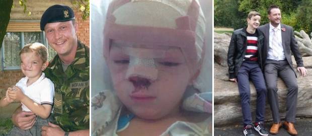 Un soldat britanic a schimbat viața unui băiat bosniac care se născuse cu o deformație facială