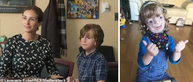 Filmul Minunea (Wonder), cu Julia Roberts ilustrează perfect cazul băiețelului